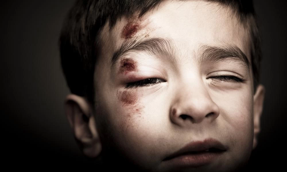 HΠΑ: Προπονητής football σωριάζει με γροθιές έναν μικρό αθλητή